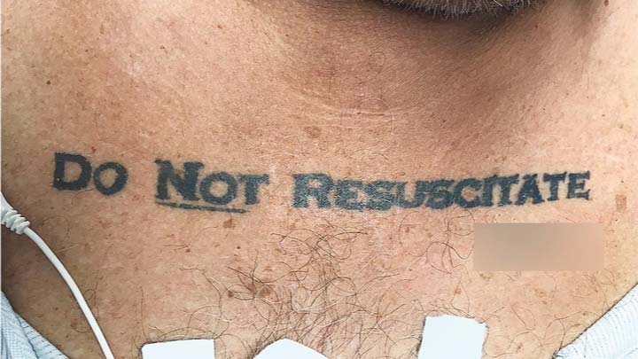 do-not-resuscitate-tattoo-ethical-dilemma